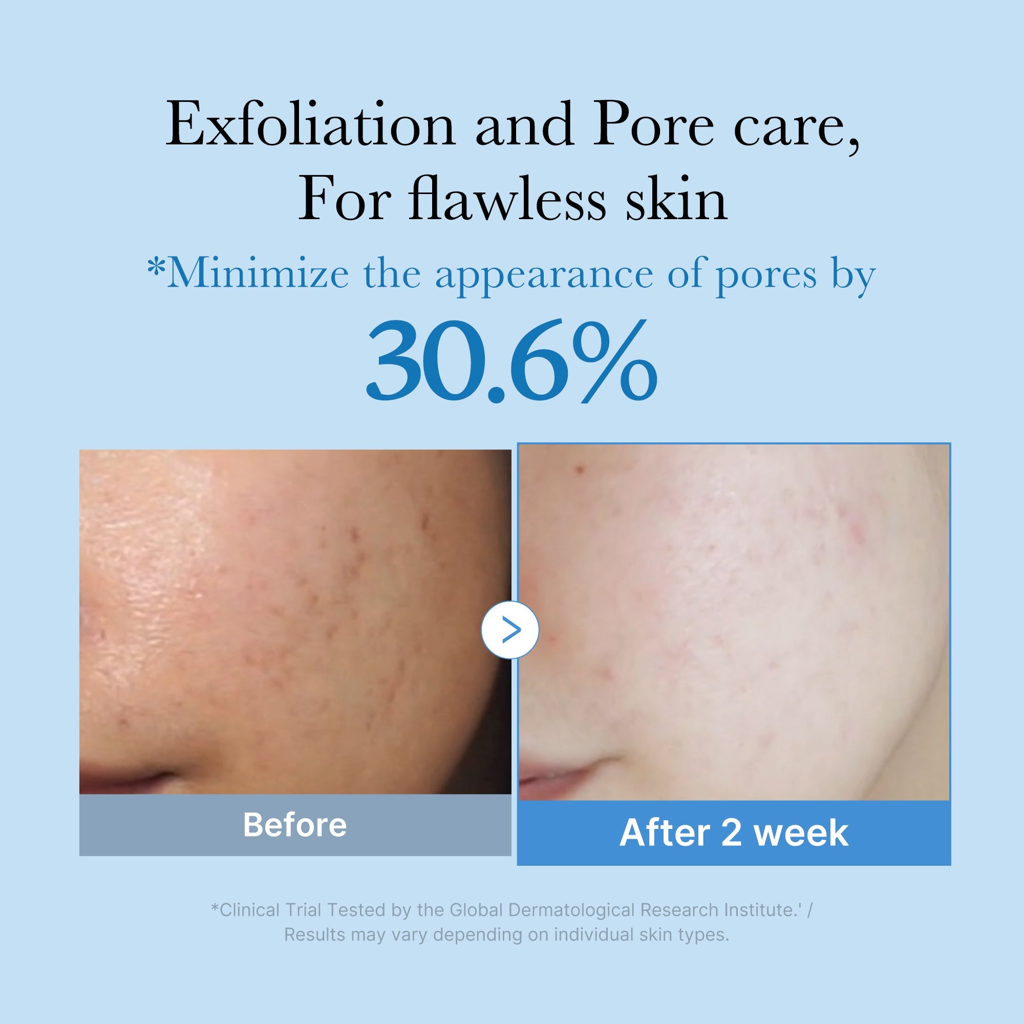 Zero Pore Toner F6