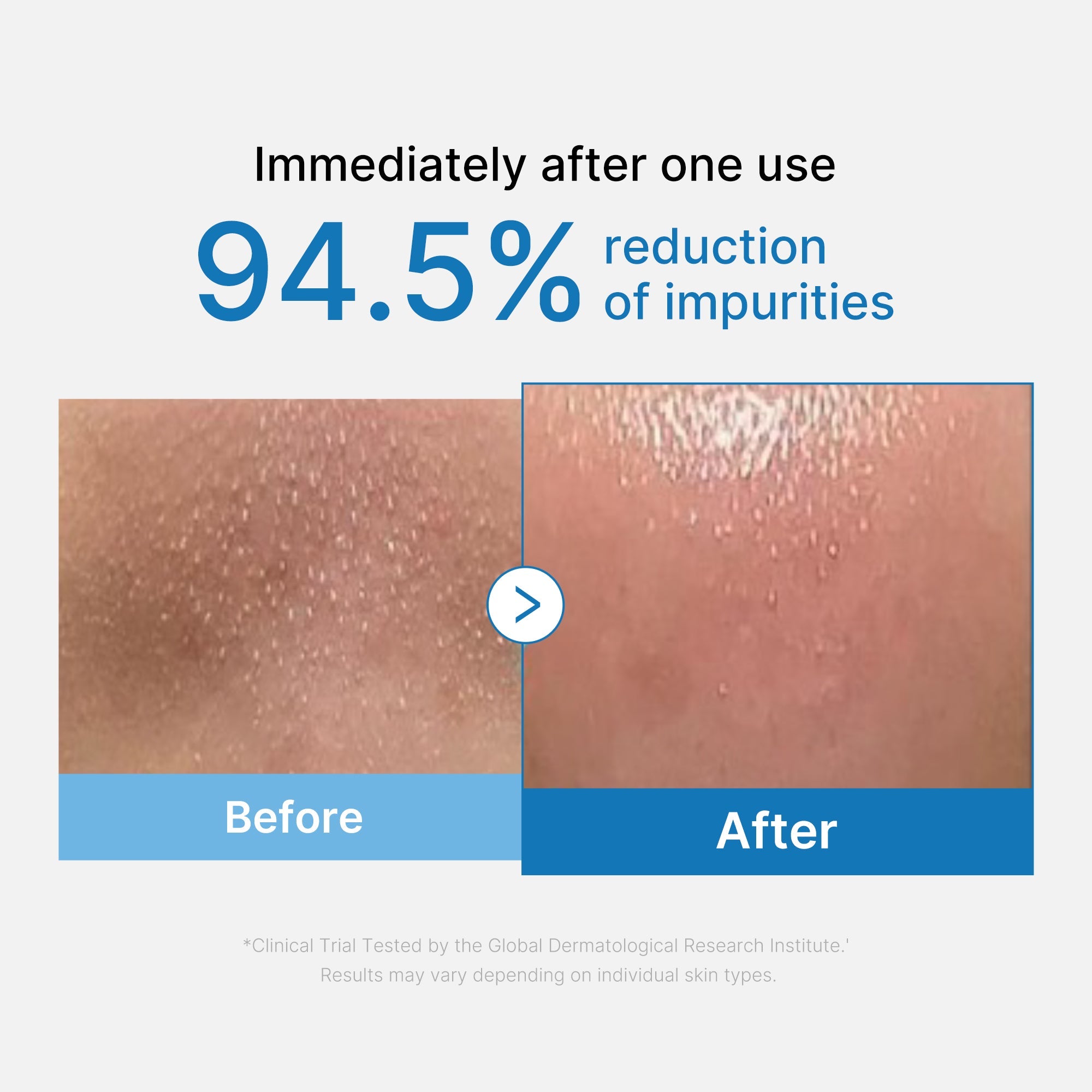 Zero Pore Blackhead Deep Cleansing Oil K1