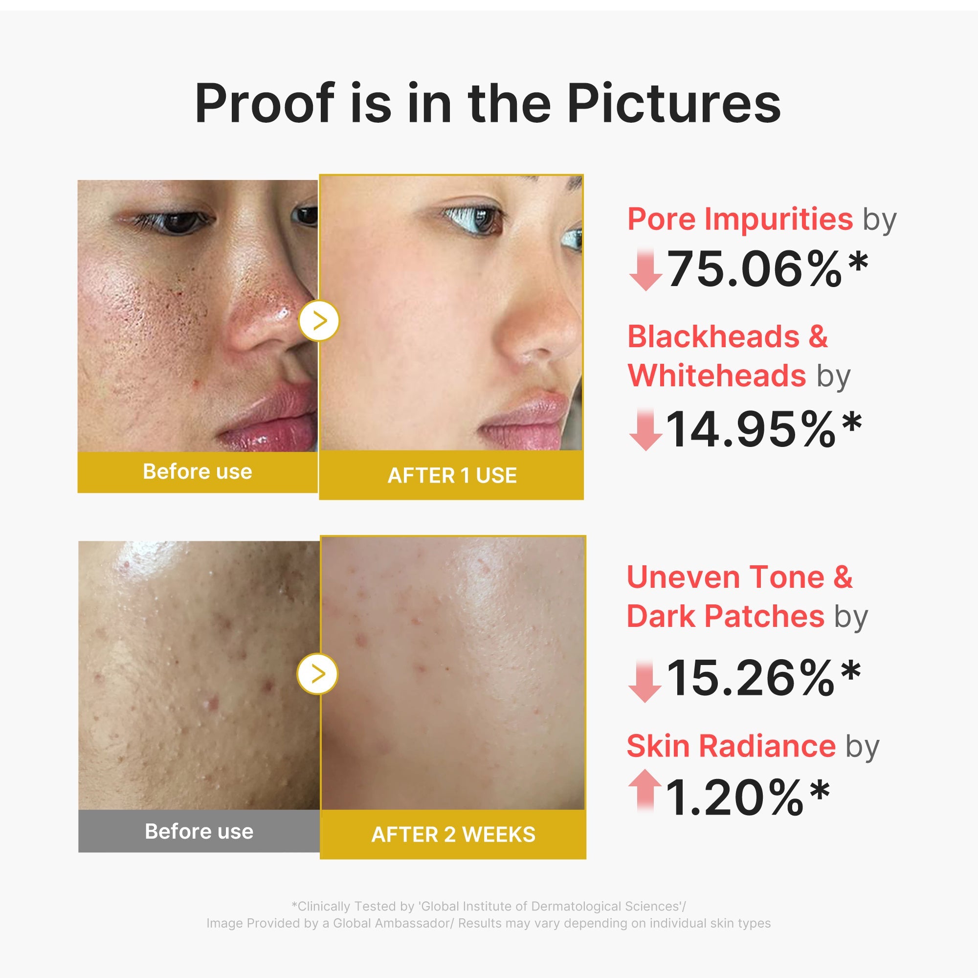 Kojic Acid Turmeric Peel Shot I7