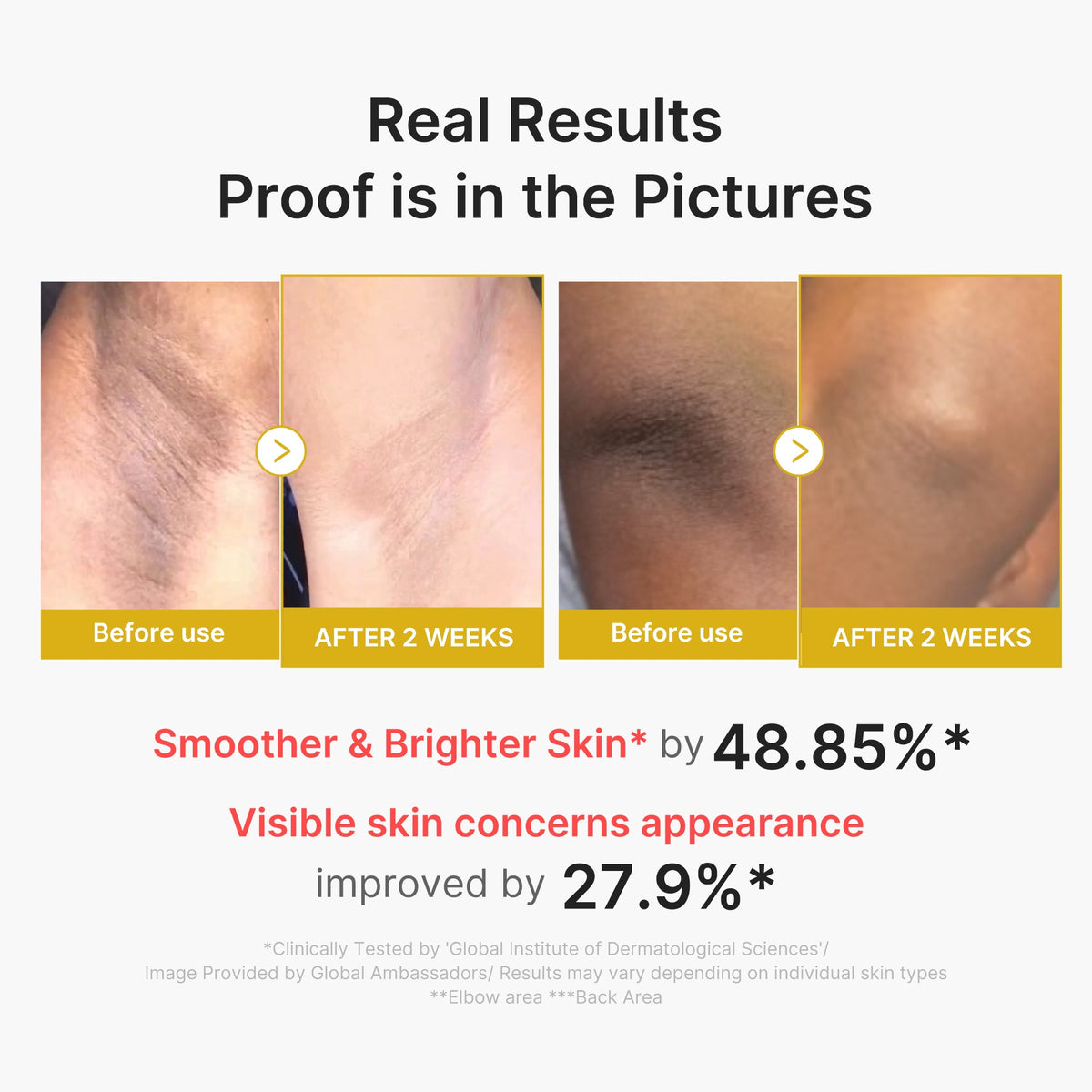 Kojic Acid Turmeric Body Peel Shot I2