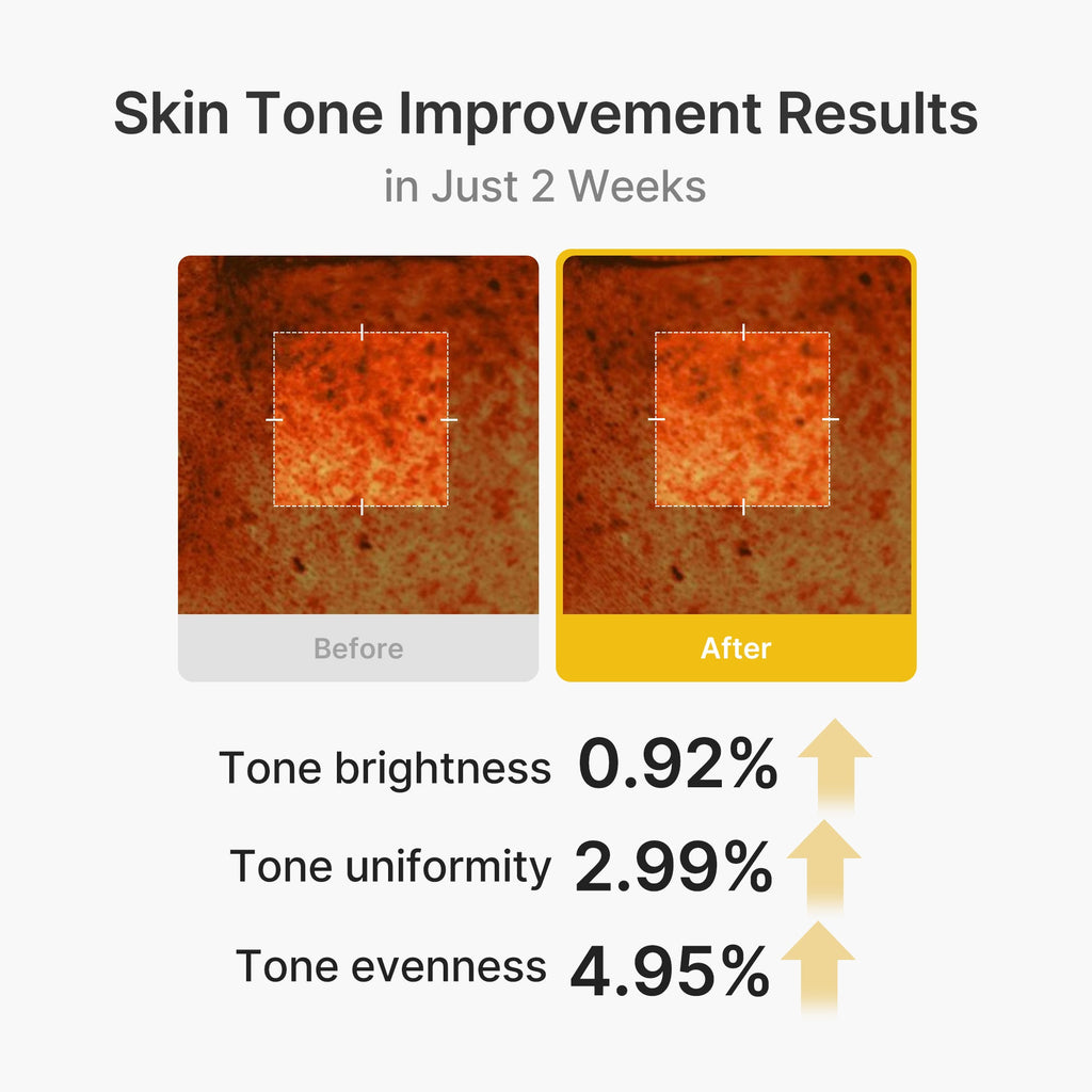 Kojic Acid Turmeric Vita Capsule Cream F5