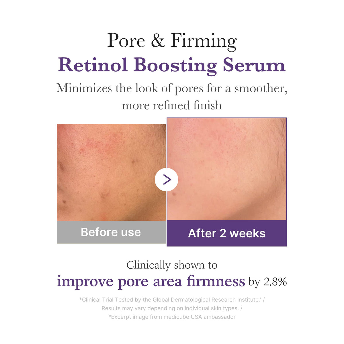 Retinol NMN Boosting Serum M3
