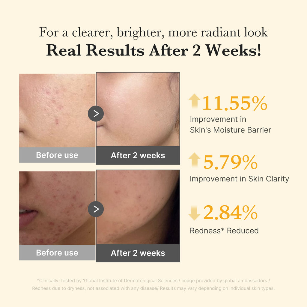 Kojic Acid Turmeric Capsule Serum A5