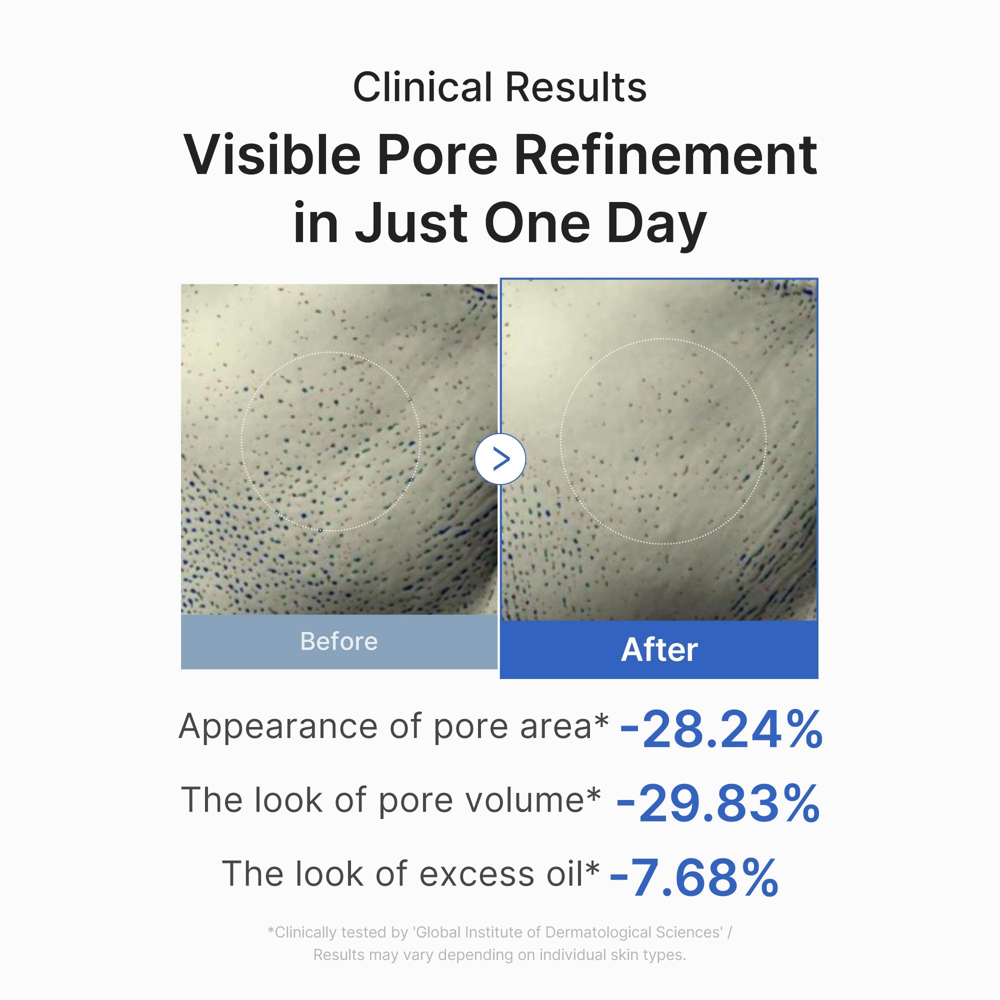 Zero Pore One-day Peptide Serum I5