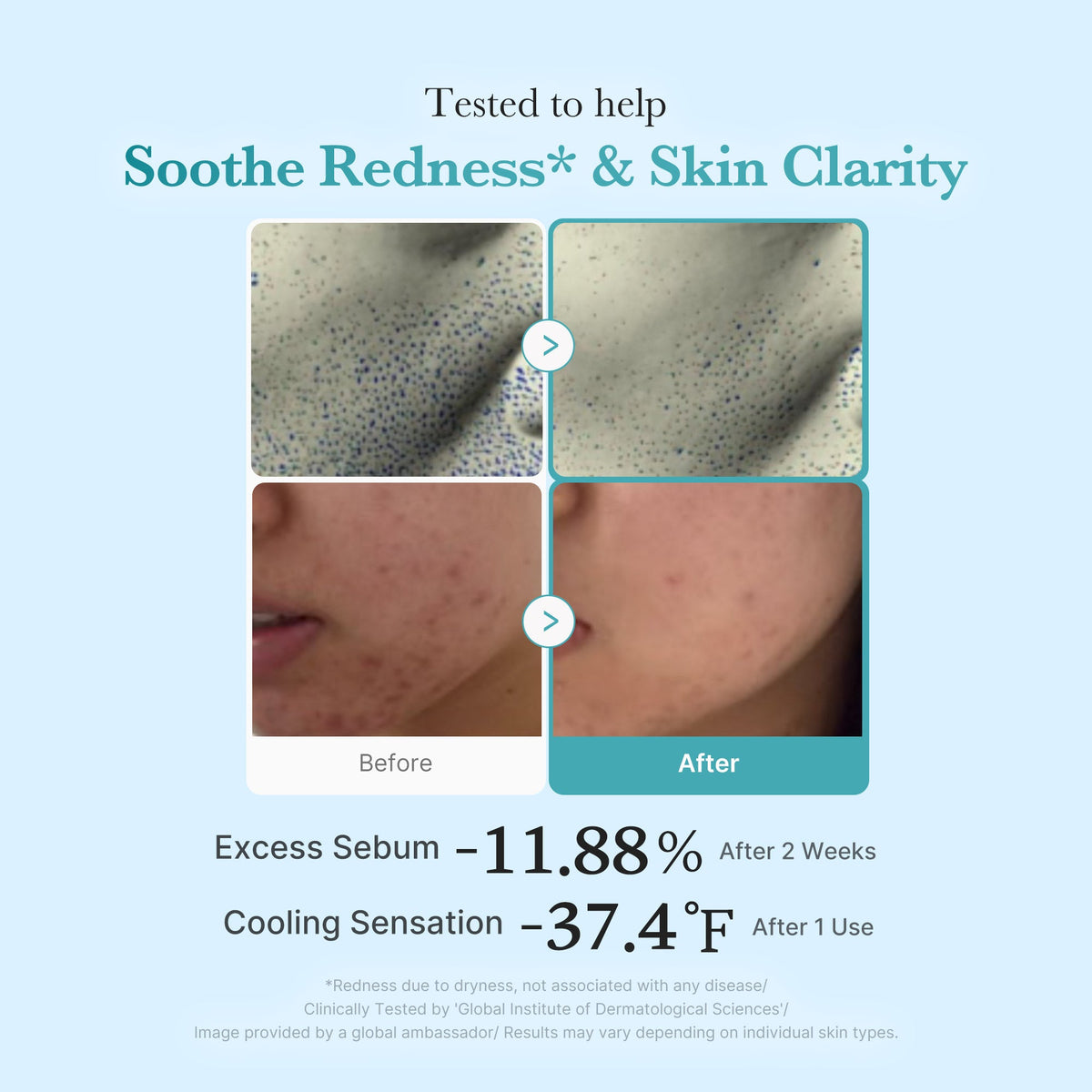 Azelaic Acid Niacinamide Clarifying Toner U3
