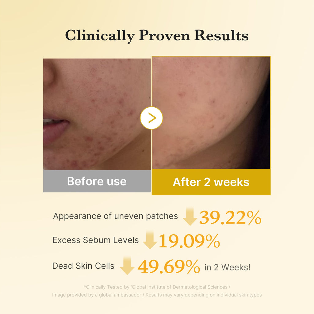 Kojic Acid Tumeric Toner Pad O2