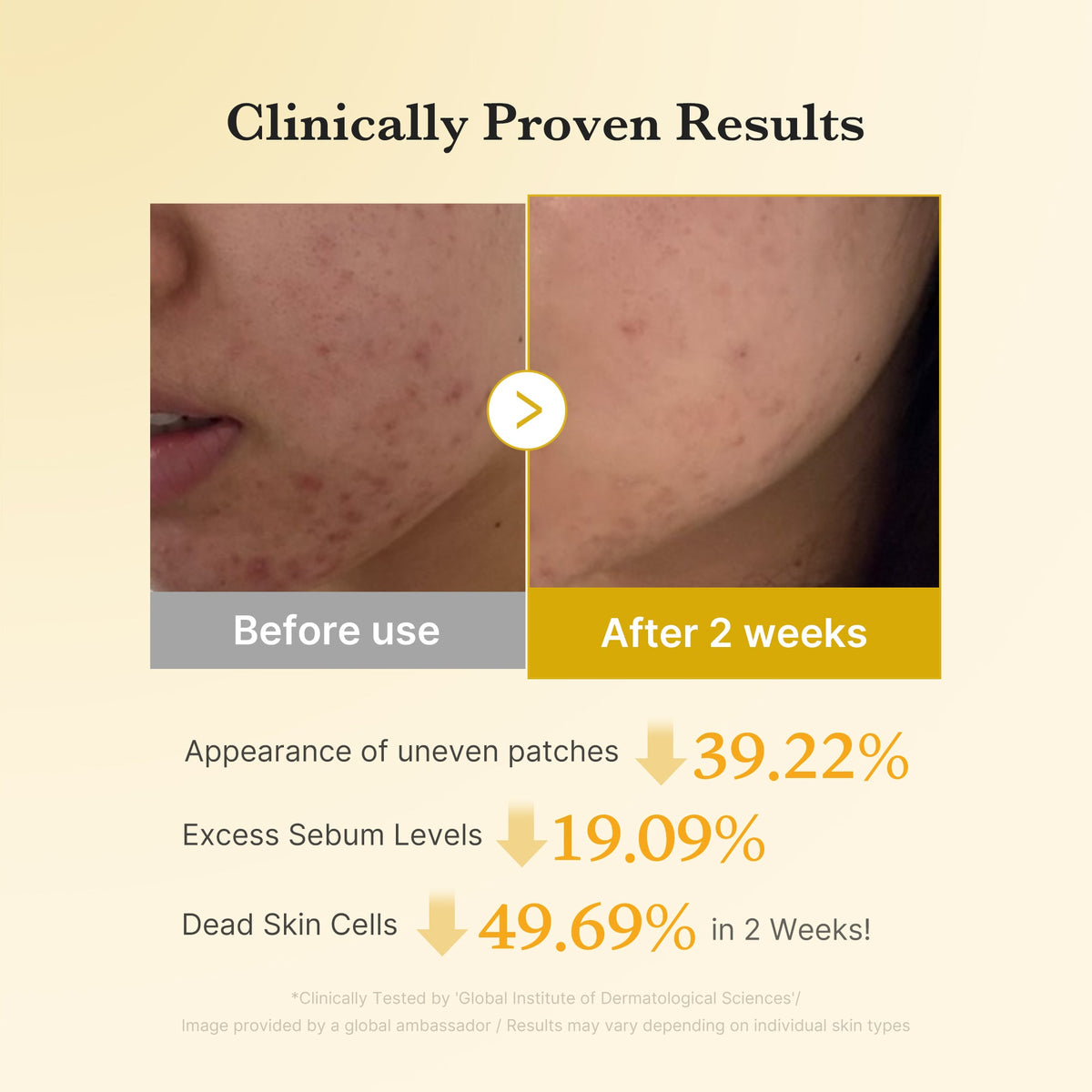 Kojic Acid Tumeric Toner Pad A6