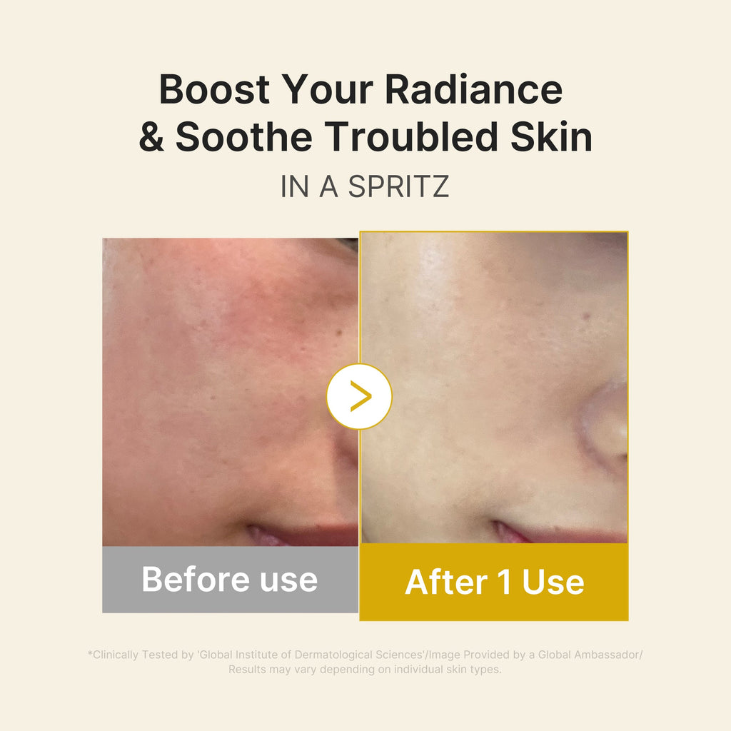 Kojic Acid Turmeric Vitamin Gold Jelly Mist Serum Y7