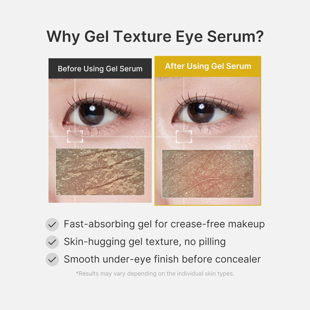 Kojic Acid Tumeric Eye Gel Serum Z4