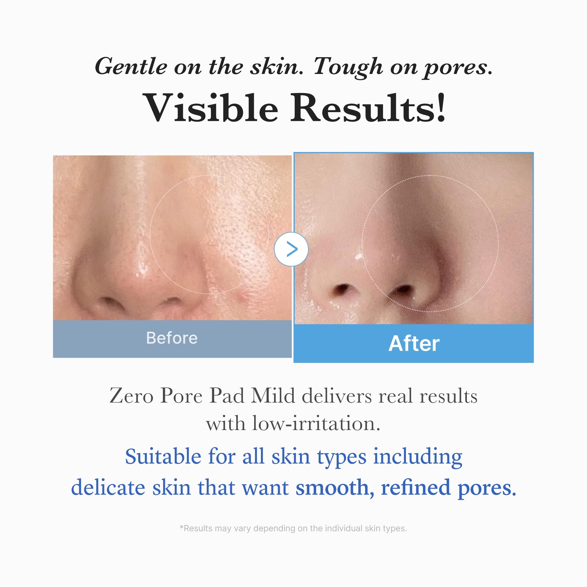 Zero Pore Madecassoside Pads (Mild) N6