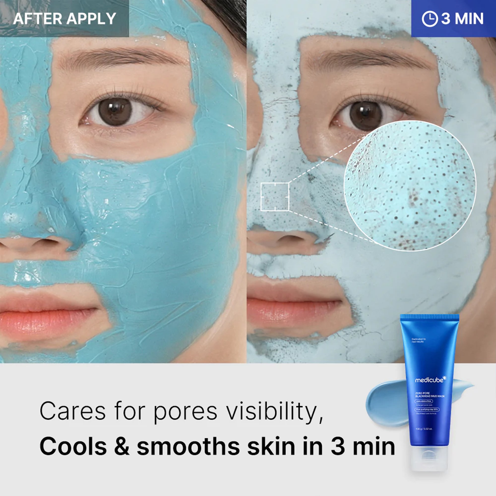 Zero Pore Blackhead Mud Mask P2