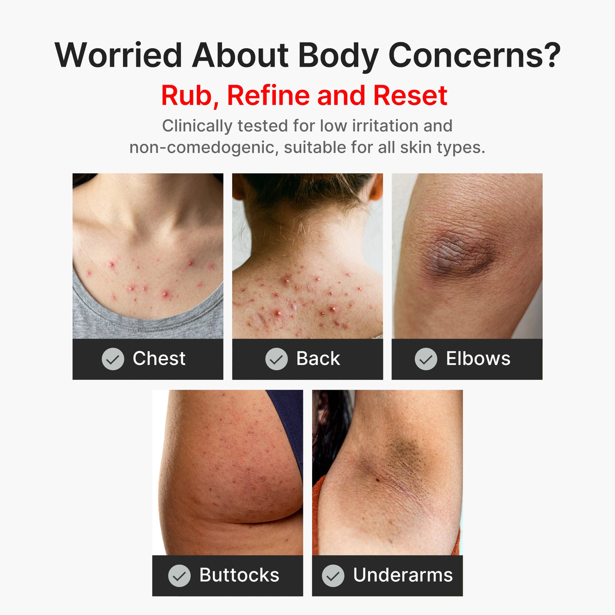 Kojic Acid Turmeric Body Peel Shot I2
