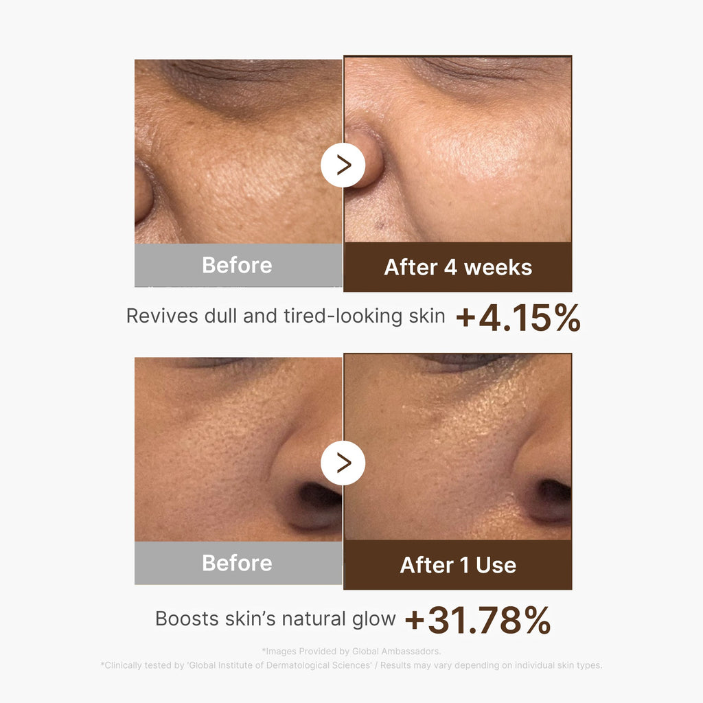 Deep Vitamin C Capsule Serum U5