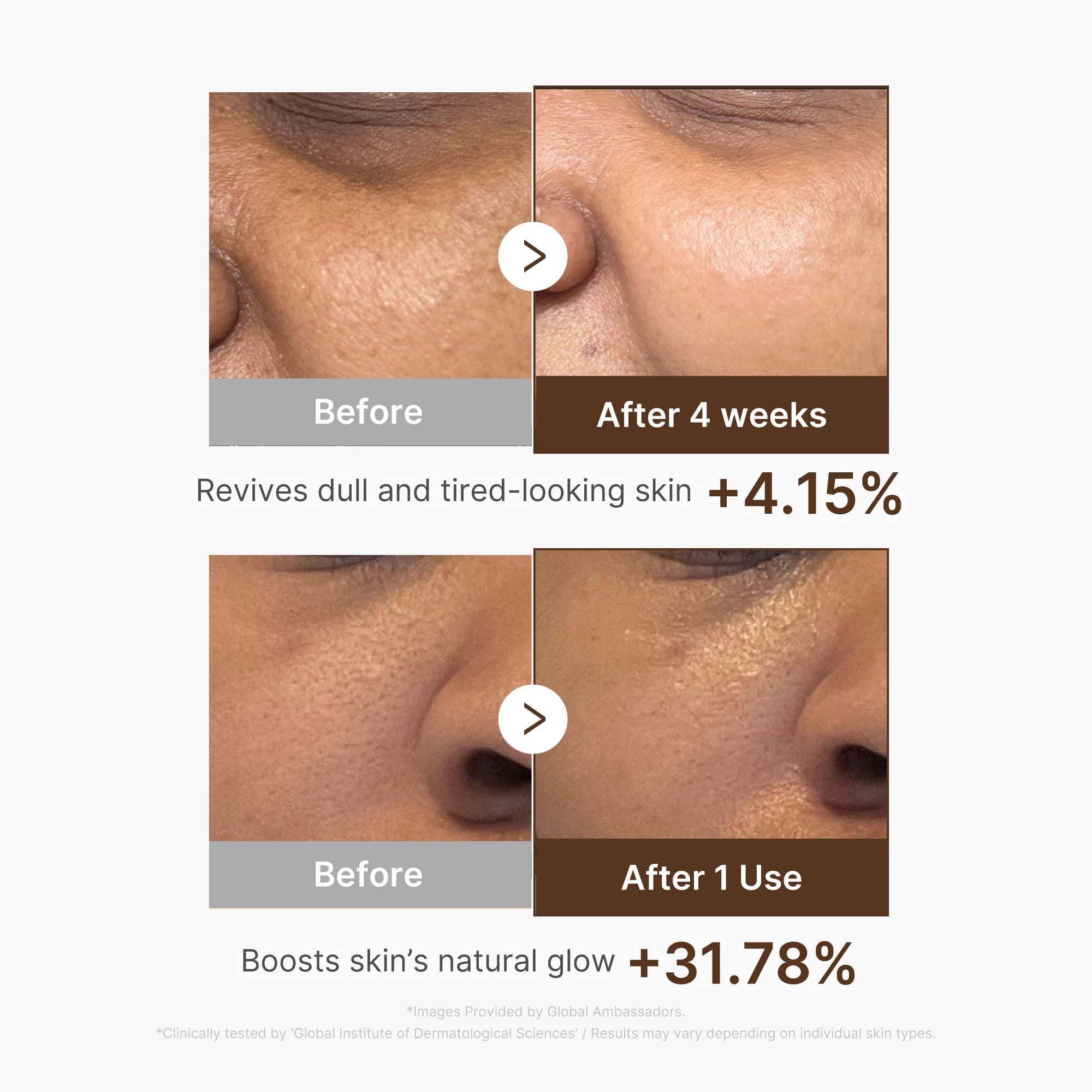 Deep Vitamin C Capsule Serum U5