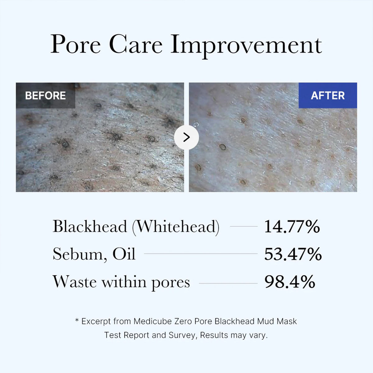 Zero Pore Blackhead Mud Mask P2