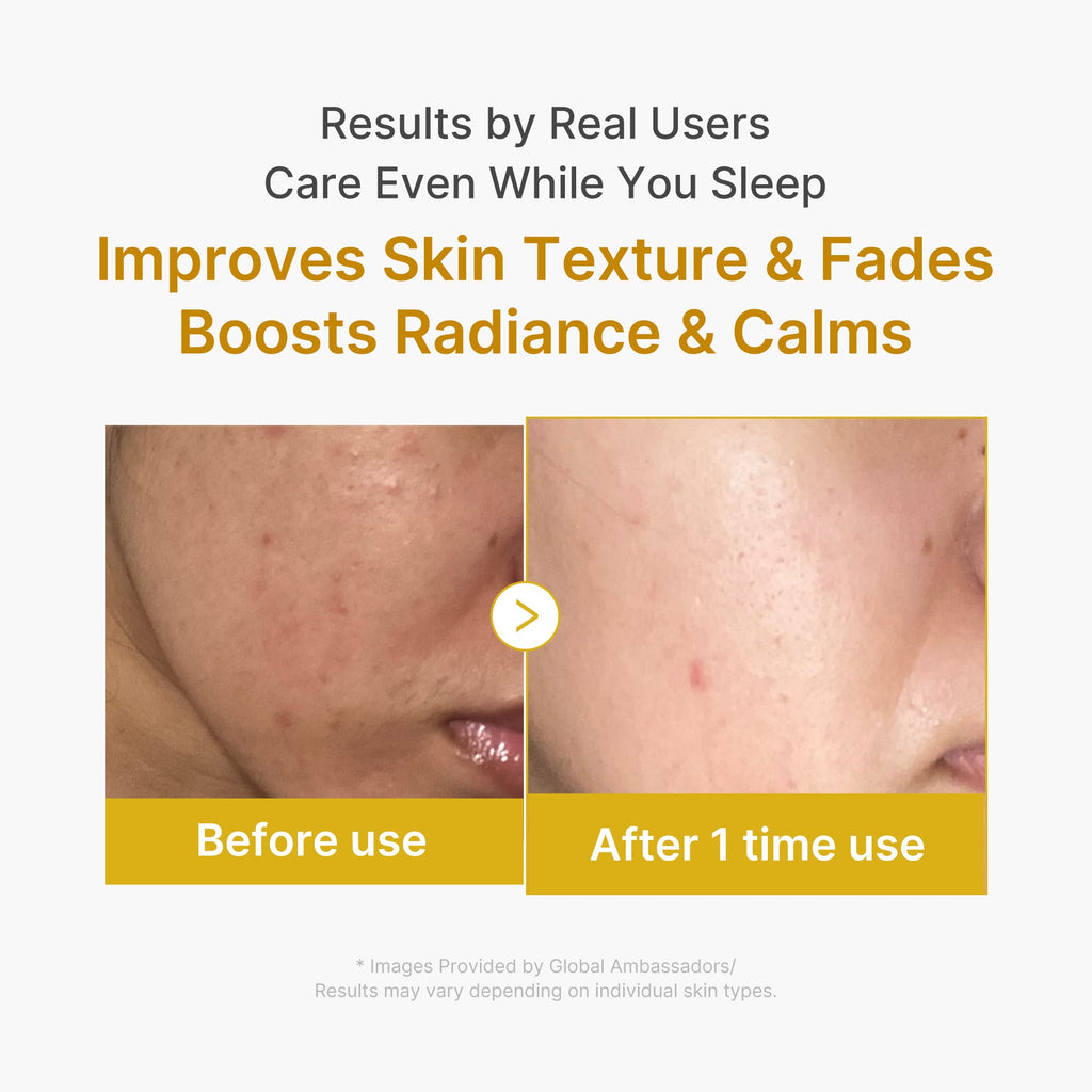 Kojic Acid Turmeric Overnight Wrapping Mask C7