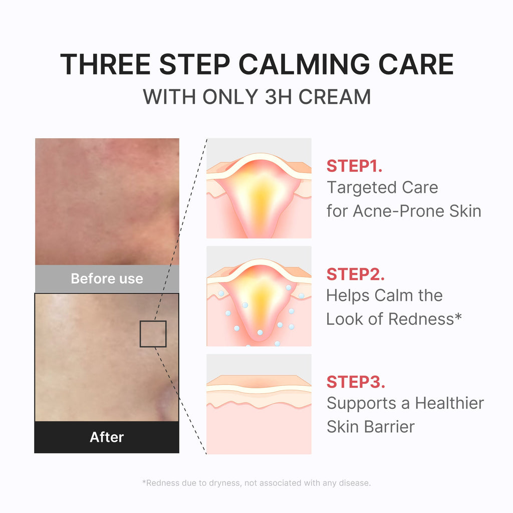 3H Daily Relief Cream T6