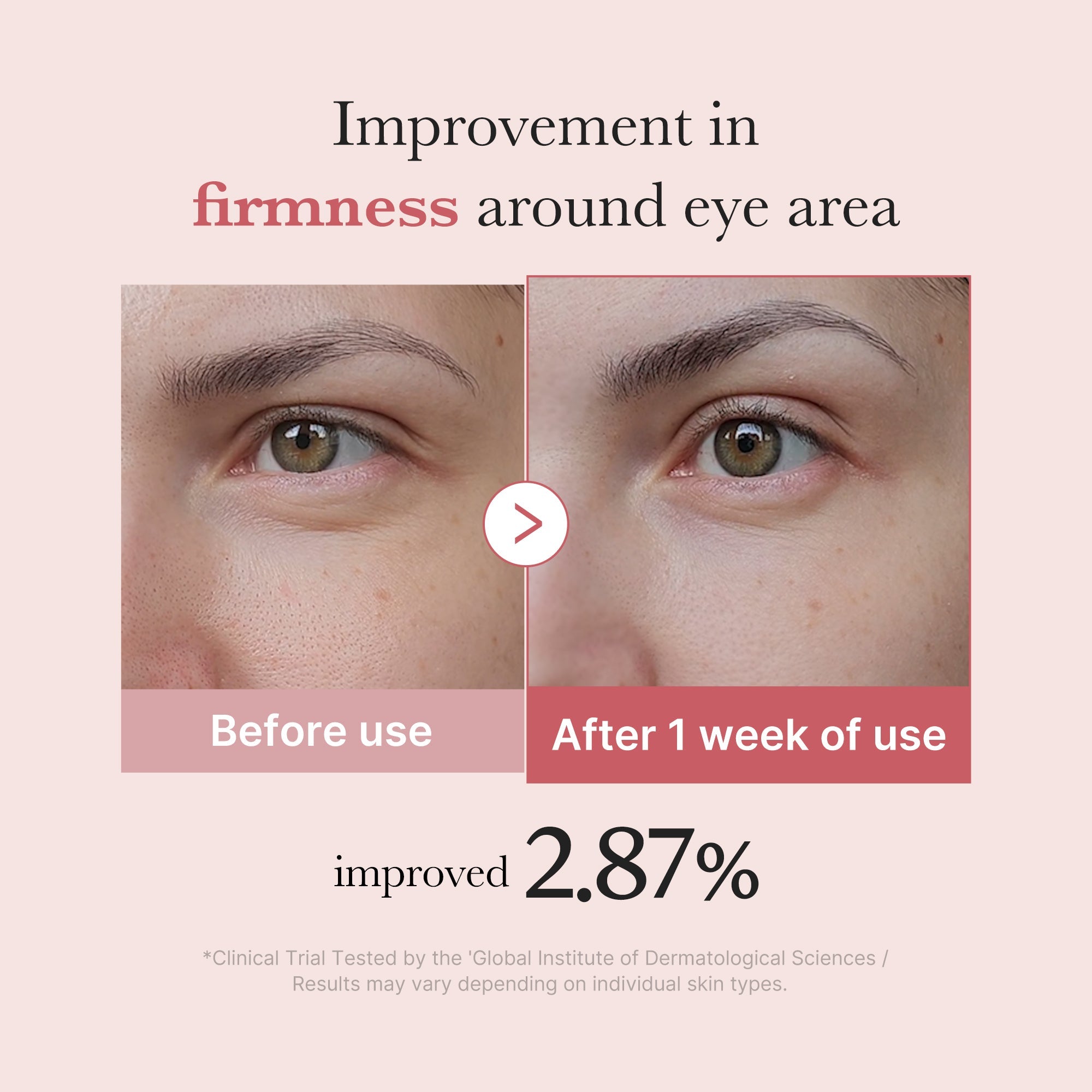 PDRN Pink Peptide Eye Cream J3