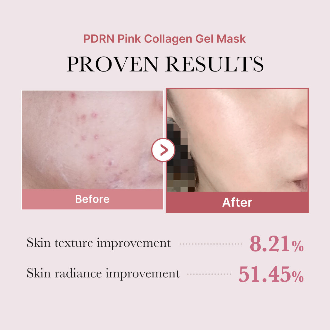 Salmon PDRN Pink Collagen Jelly Gel Mask R0
