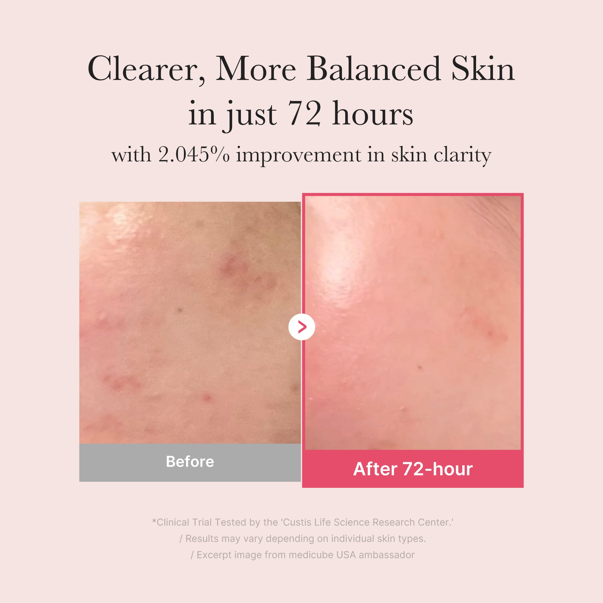 TXA Niacinamide Serum Q4