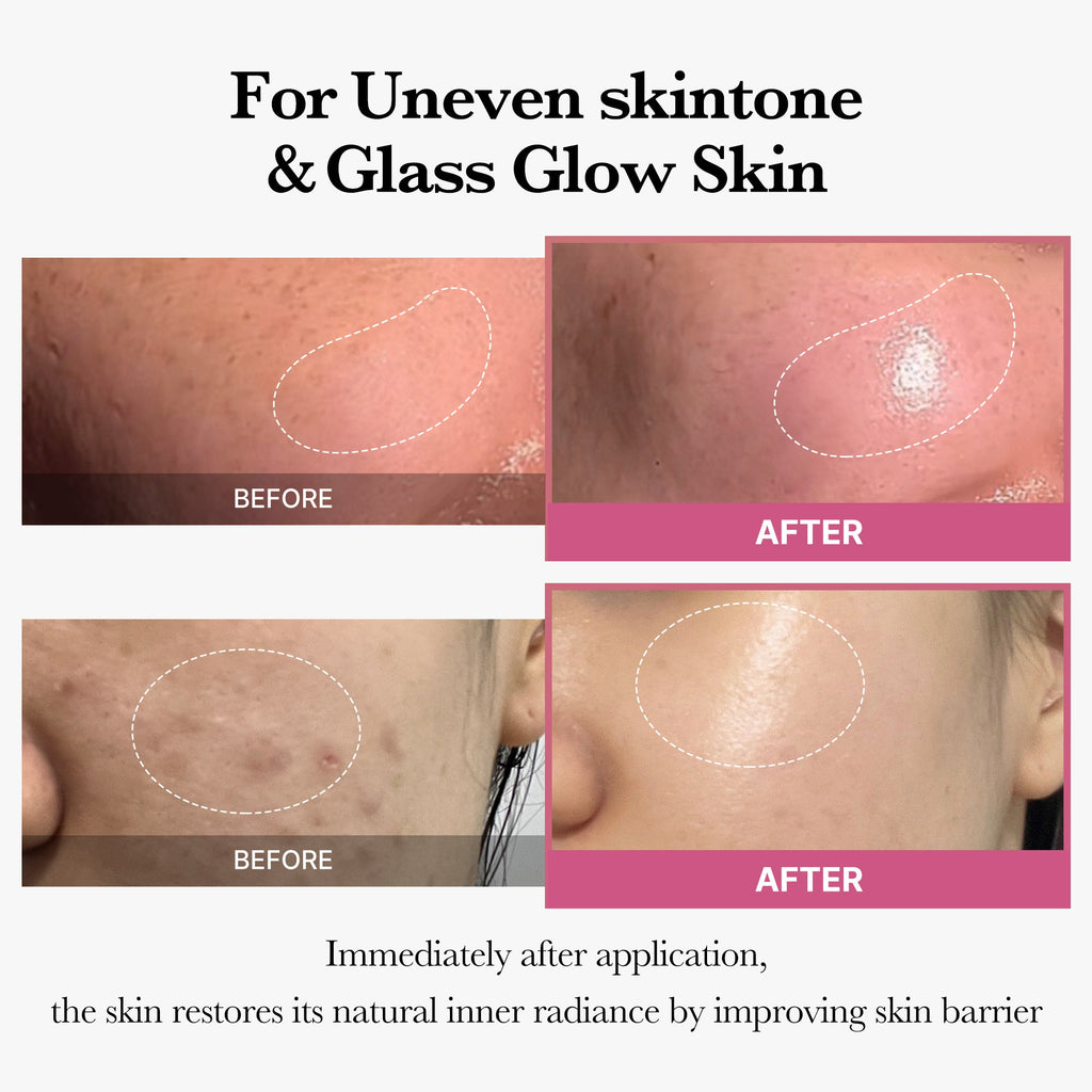[Tati's Exclusive] All About Glow Set V8